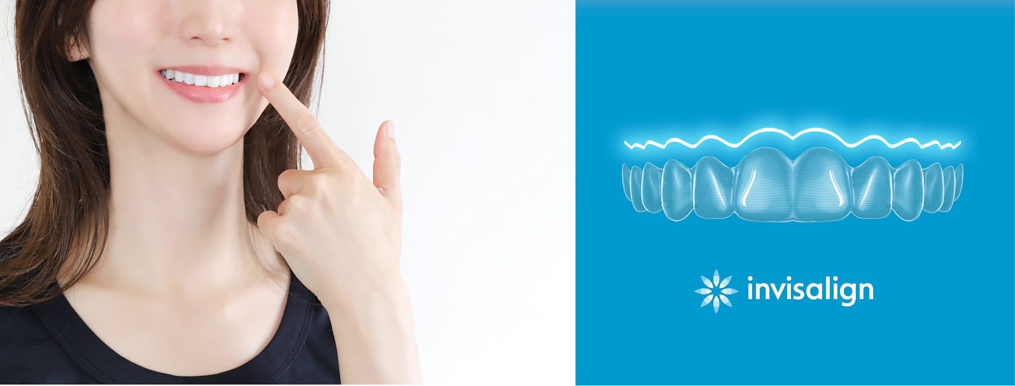 成人矯正について